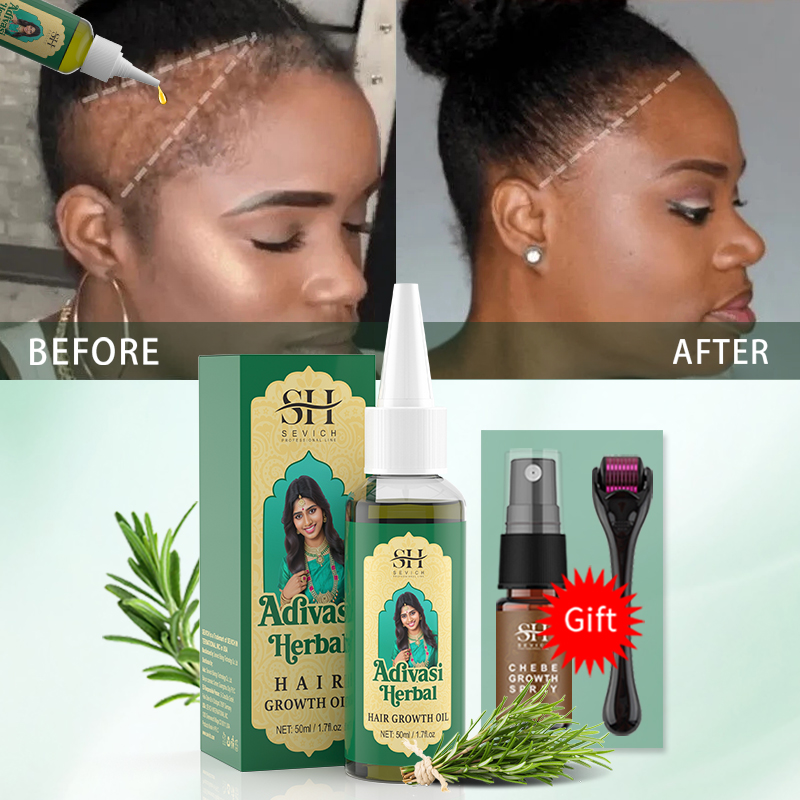 Ayurvedic Hair Growth Oil Indi - مراجعة Biotin Hair Growth وسعره