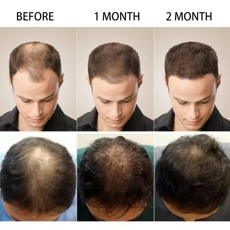 Hair Growth Ginger Fast Growin - مراجعة Biotin Hair Growth وسعره