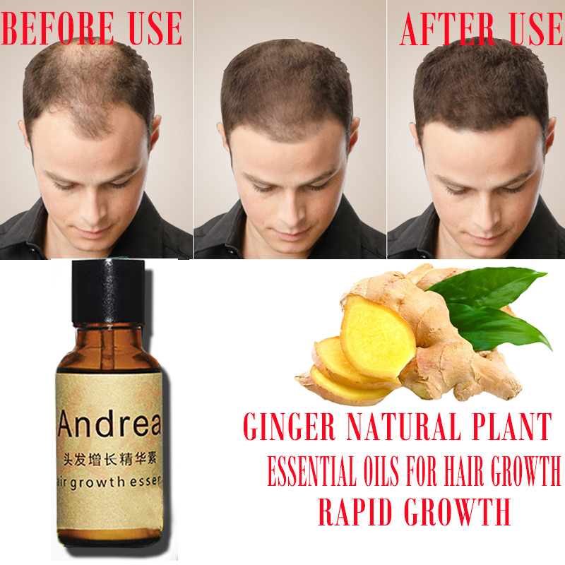 2/5/10Pcs Andrea Hair Growth S - مراجعة Biotin Hair Growth وسعره