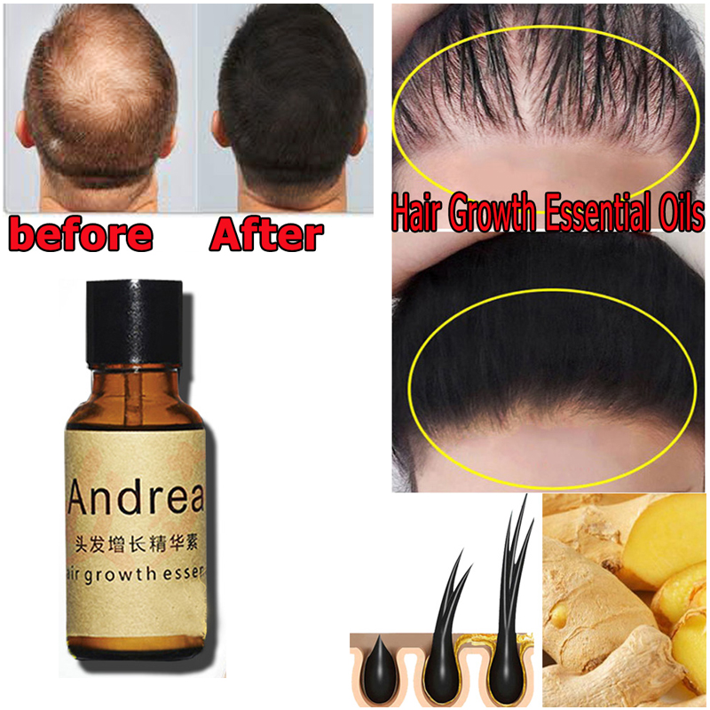 2/5/10Pcs Andrea Hair Growth S - مراجعة Biotin Hair Growth وسعره